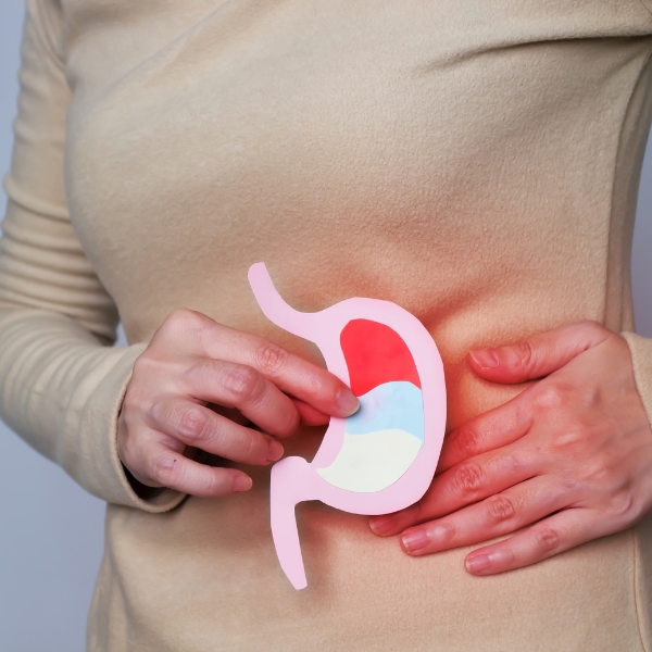Acid Peptic Disorder Hyperacidity Gastric Ulcer