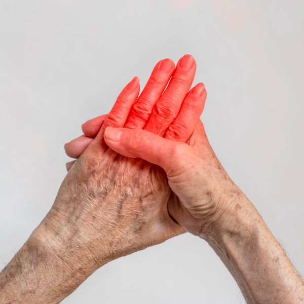 Gouty Arthritis